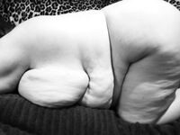 Side view of a fatty